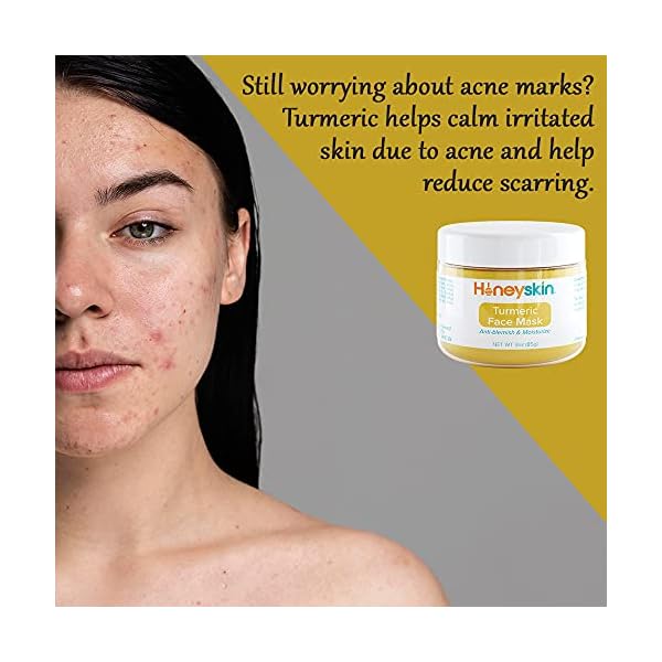 Turmeric-Face-Mask-for-Sensitive-Skin-Deep-Pore-Cleansing-Mask-Skin-Moisturizing-Face-Mask-Organic-Face-Mask-Skin-Care-with-Manuka-Honey-Kaolin-Clay-and-Bentonite-Clay-Mask-3oz Turmeric Face Mask Acne Scars and Dark Spot Remover - Deep Pore Minimizer and Anti Aging Face Mask - Skin Moisturizing Face Mask - Face Moisturizer for Glowing Skin and Pimple Spot Treatment (3oz)