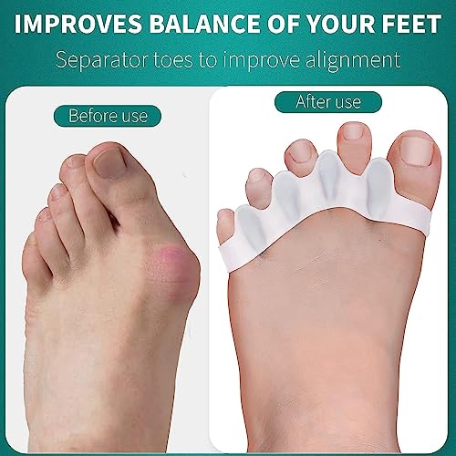 Image of Toe Separator for Feet Toe Spacers Correct Toes Yoga Silicone Hammer Toe Corrector for Women & Men Correct Toe Straighteners for Overlapping Toes (A F t separator)