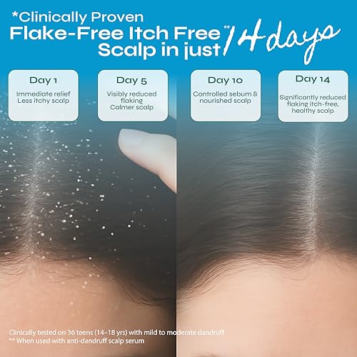 Image of Tikitoro Teens Anti-Dandruff Scalp Serum with Joazeiro, Black Pepper, and Neem Promotes Good Microbes, Fights Dandruff Causing Fungi, Reduces Flaking and Itching, All Skin Types (Age: 11+) (100ml x 1)