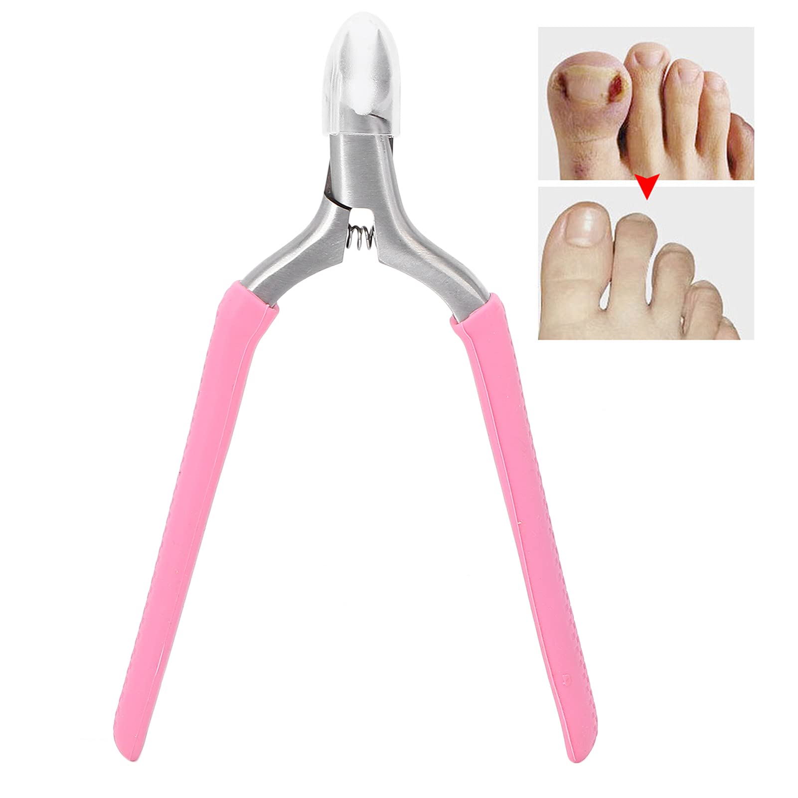 Tronchese Per Unghie Spesse Incarnite, Tronchese per Cuticole, taglia cuticole Nipper Tagliaunghie in acciaio inossidabile Strumento per la rimozione dei calli per la rimozione della pelle morta