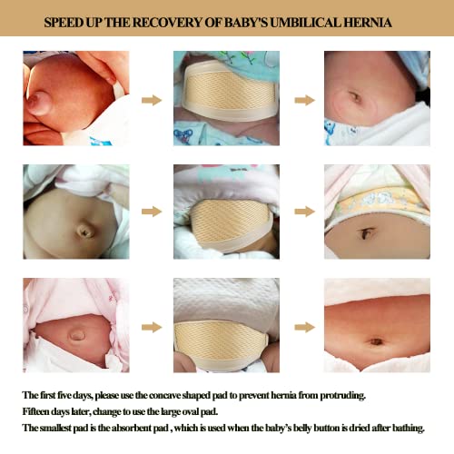 Image of Umbilical Hernia Belt Baby Belly Button Band Infant Belly Wrap Truss Abdominal Binder for Children Kids Support Adjustable Navel Belly Band Newborn Umbilical Cord 15-20 inch