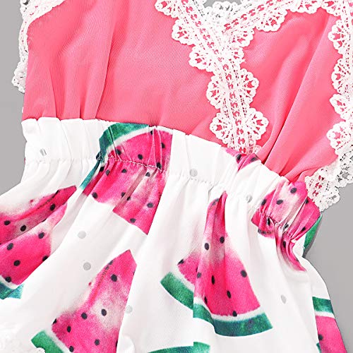Summer Toddler Baby Girl Clothes Cute Fruit/Flower Print Lace Trim Backless Romper Shorts Jumpsuit (Pink, 6-12 Months) #TOP4