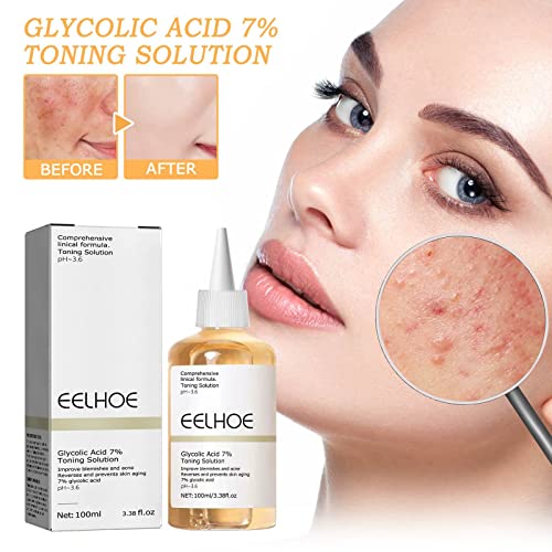 Glycolic Acid 7% Toning Resurfacing Solution - Ordinary Glycolic Acid Toning Solution, Glycolic Acid Serum Face, Facial Exfoliation Astringe Pores, Anti Aging Brighten Skin Colour (1Pc) #TOP1