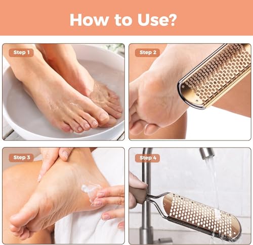 Easkep Foot File Foot Scrubber Pedicure - Callus Remover for Feet Easkep Professional Grater Rasp Foot Scraper Corns Callous Removers Cracked Dead Skin Remover for Dry and Wet Feet (Golden)