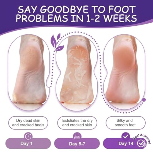 Image of Exfoliating Foot Peeling Mask Socks for Men & Women | Dead Skin Remover Foot Mask Removes Calluses & Cracked Heels | Hydrating Lavender Foot Peel Booties | for Soft Smooth Feet Care K Beauty Night Care (PACK OF 02)