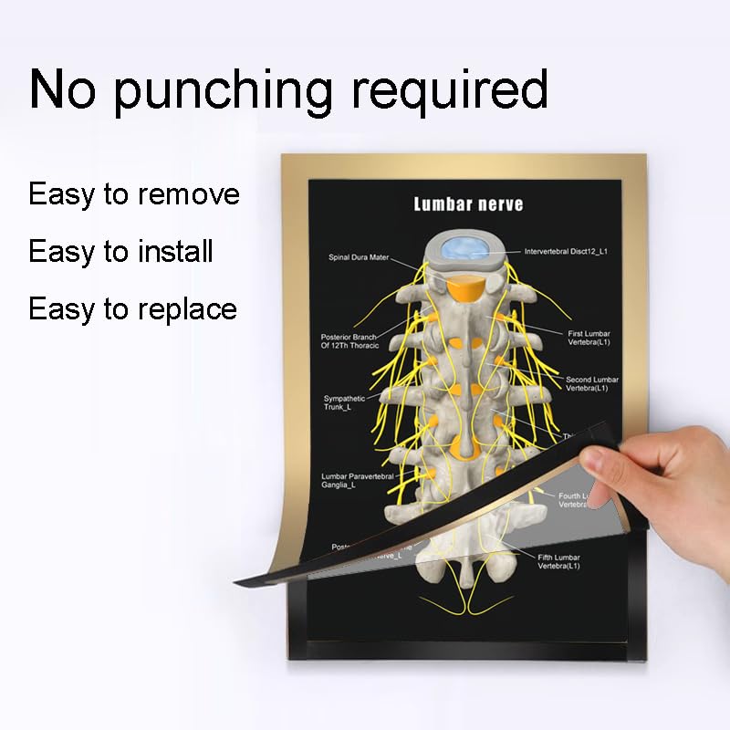 Image of Taanfu Body Educational Learning Anatomy Posters ，Lumbar nerve Art Lumbar Villi Anatomy Art Poster Digestive System Organs Illustration Small Intestine Physiology Anatomy Wall Art Villi