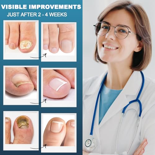 Nagelpflege Behandlung 30ml, Nagelpflege Serum, Intensiv Nagelöl für Männer und Frauen, Tiefenpflege für geschwächte Nägel, Regeneriert Nagelstruktur, Repariert rissige und splitternde Näge