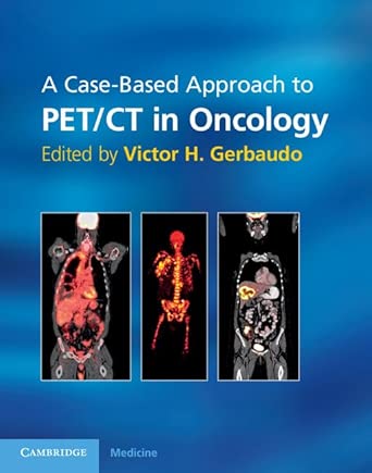 A Case-Based Approach to PET/CT in Oncology (Cambridge Medicine (Hardcover)) book cover