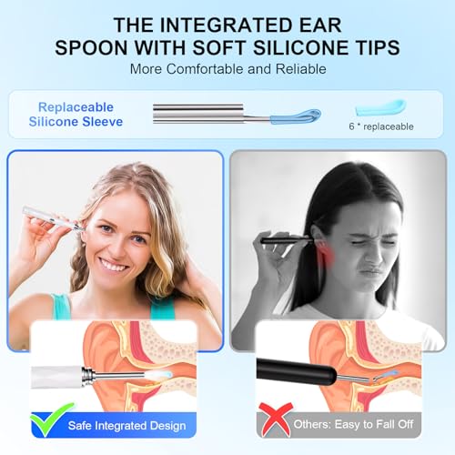 Image of High-Definition Ear Wax Removal, Wireless Ear Cleaner, Safe and Gentle Ear Wax Removal Kit, Rechargeable Ear Cleaner with Camera and Light, Ear Cleaning Kit for Android and iOS (White)