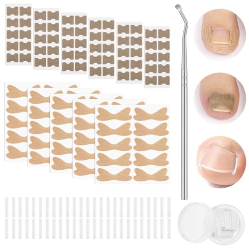 ALIIP Kit Complet Ongles Incarnés 160 Pièces, Correcteur avec Tubes, Pansements et Outils, Solution Professionnelle pour un Traitement Efficace à Domicile, B