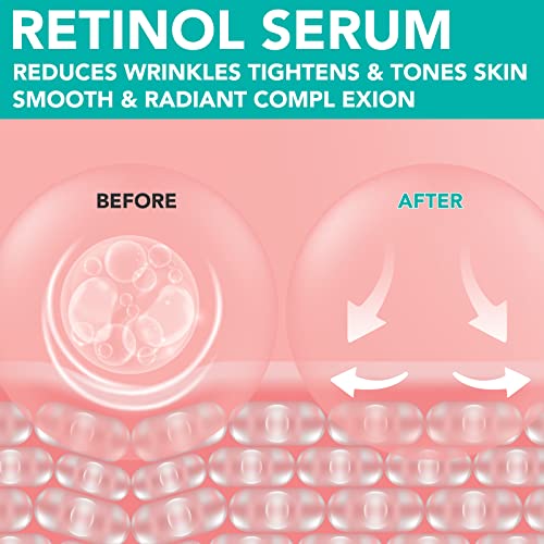 Retinol Serum - 60Ml Retinol Liposome Delivery System With Hyaluronic Acid And Vitamin E, Aloe, Anti Aging Retinol Serum For Skin Repair, Fine Line And Wrinkles #TOP6