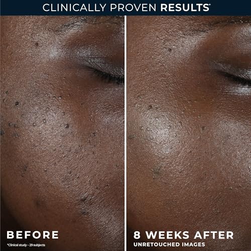 RoC Niacinamide Even Tone + Lift Anti Aging Night Cream, Face Moisturizer - image 5