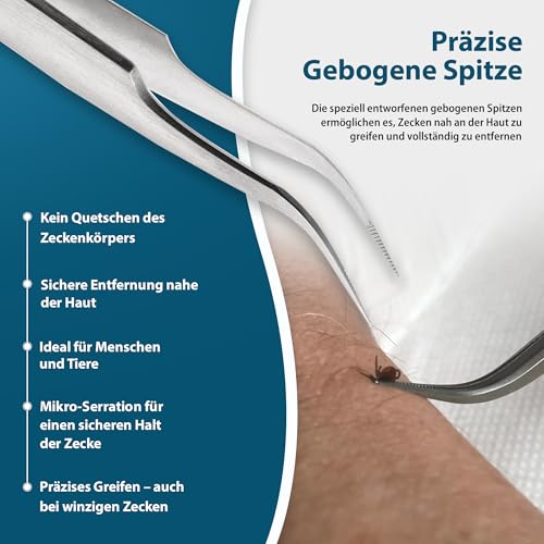 REMOS Zeckenzange Zeckenpinzette Edelstahl rostfrei mit gebogener Spitze für Menschen und Tiere