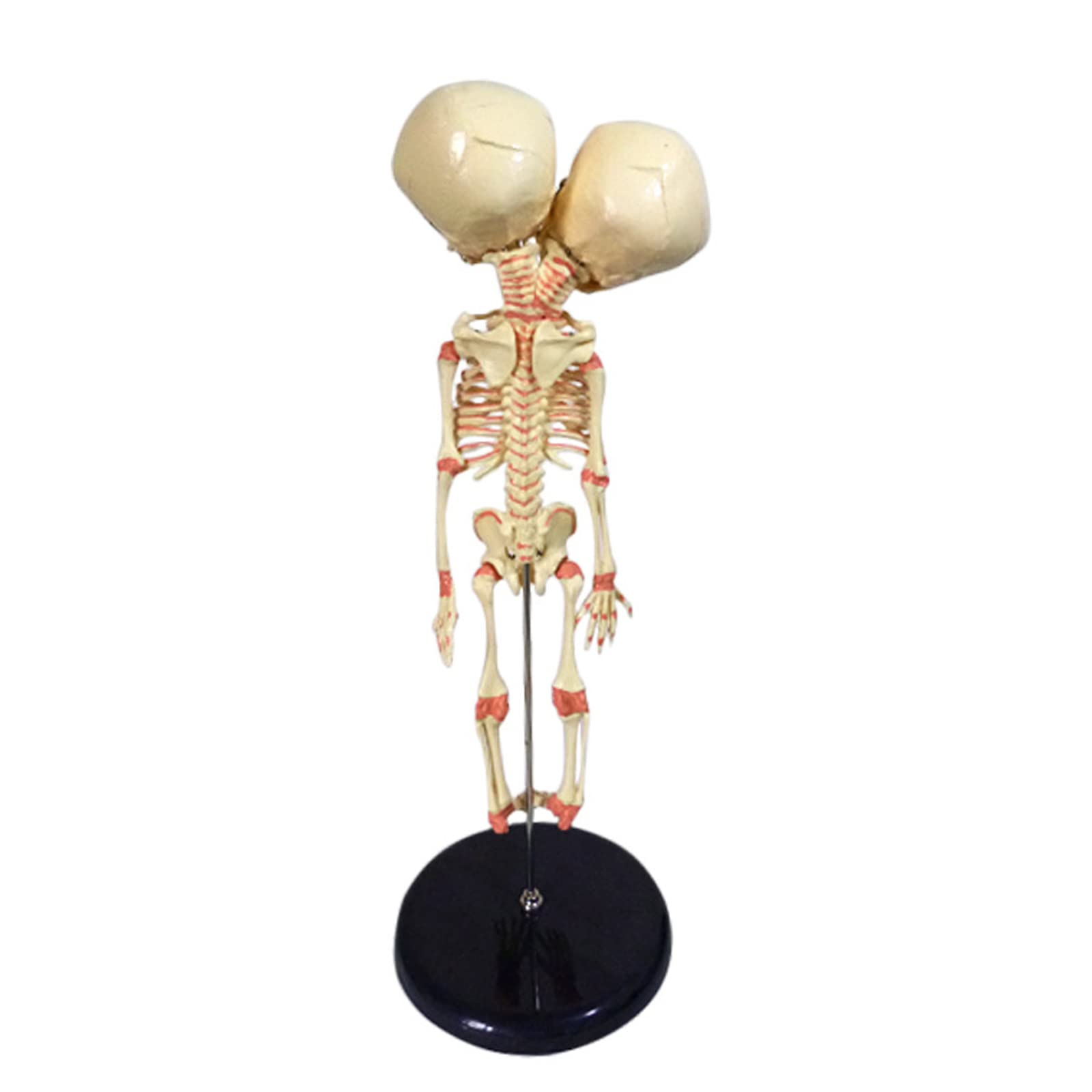 Amazon.com: SGeneE Two Headed Baby Skeleton Model Human Anatomical