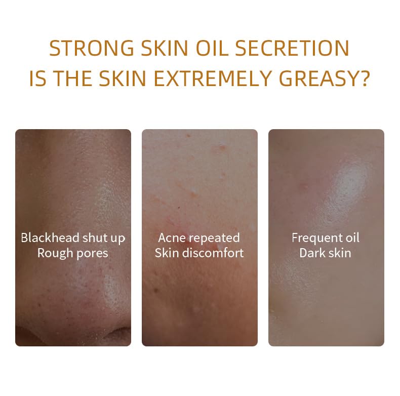 Miniatura 2 de Kit de máscara de arcilla orgánica de etiqueta privada Cúrcuma té verde rosa rosa cara barro máscara facial máscara facial para piel de acné (juego