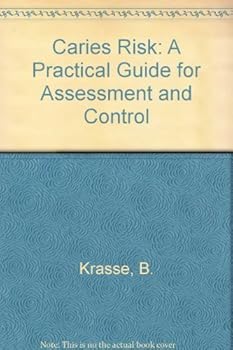 Paperback Caries Risk: A Practical Guide for Assessment and Control Book