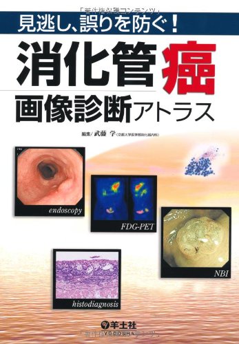 キンドル 無料電子書籍 消化管癌画像診断アトラス―見逃し、誤りを防ぐ! バイ