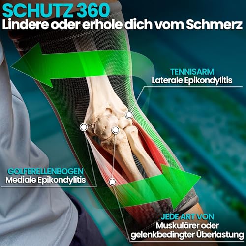 NativoDex Ellenbogenbandage – Kompressionsbandage für Ellenbogen, Bandage für Tennisarm, Golferarm, Sehnenentzündung, Arthrose, Sport - Armbandage Herren und Damen