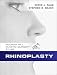 Rhinoplasty
