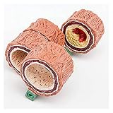 HAILIA Modelo de aterosclerosis, Modelo de arteria de 4 Piezas, réplica de anatomía del Cuerpo Humano de construcción para Herramienta educativa