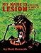 My Name Is Lesion: A Collection of Unhealthy Tales