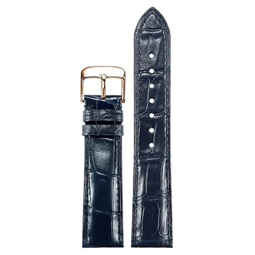 [ȓX] 18mm19mm20mm21mmAQ[^[U[Xgbvi|jApebN tBbv IWC W NR_CU[uXbg o^tCNXvxgΉ(Blue D rose,18mm)