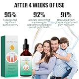 Zoom IMG-2 gel per la rigenerazione delle Zoom IMG-2 gel per la rigenerazione delle