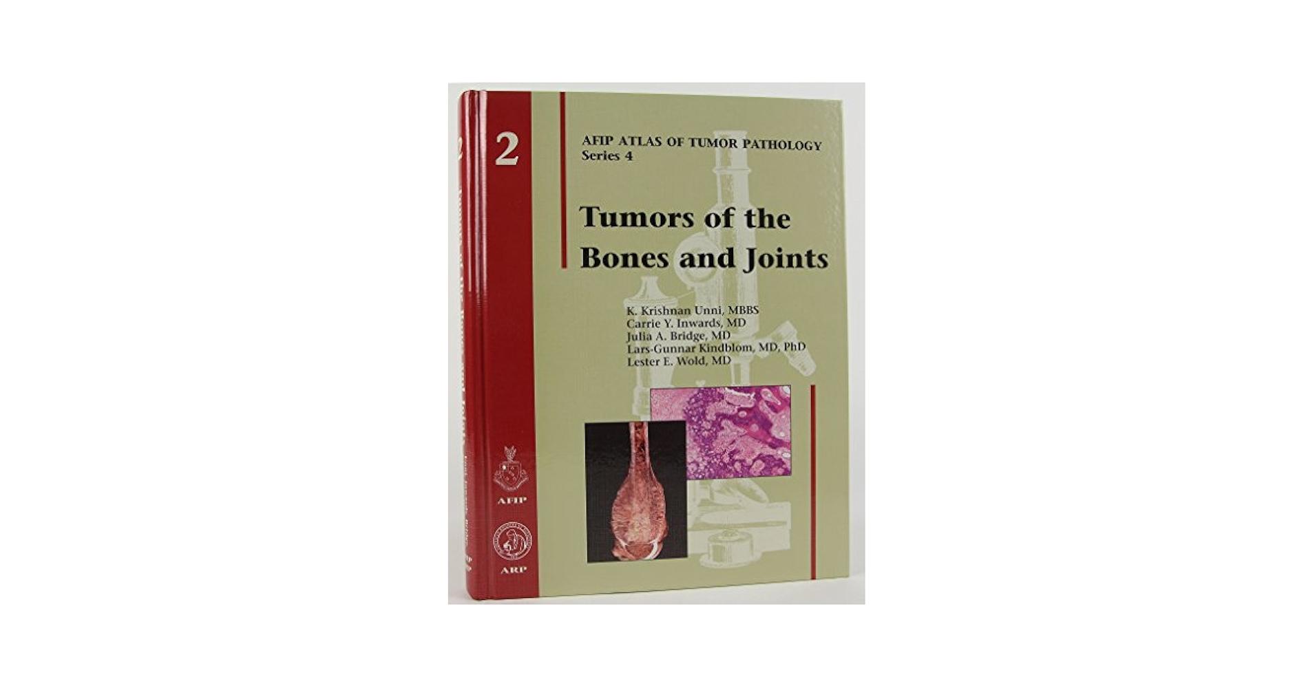 Tumors of the Bones and Joints (Atlas of Tumor Pathology