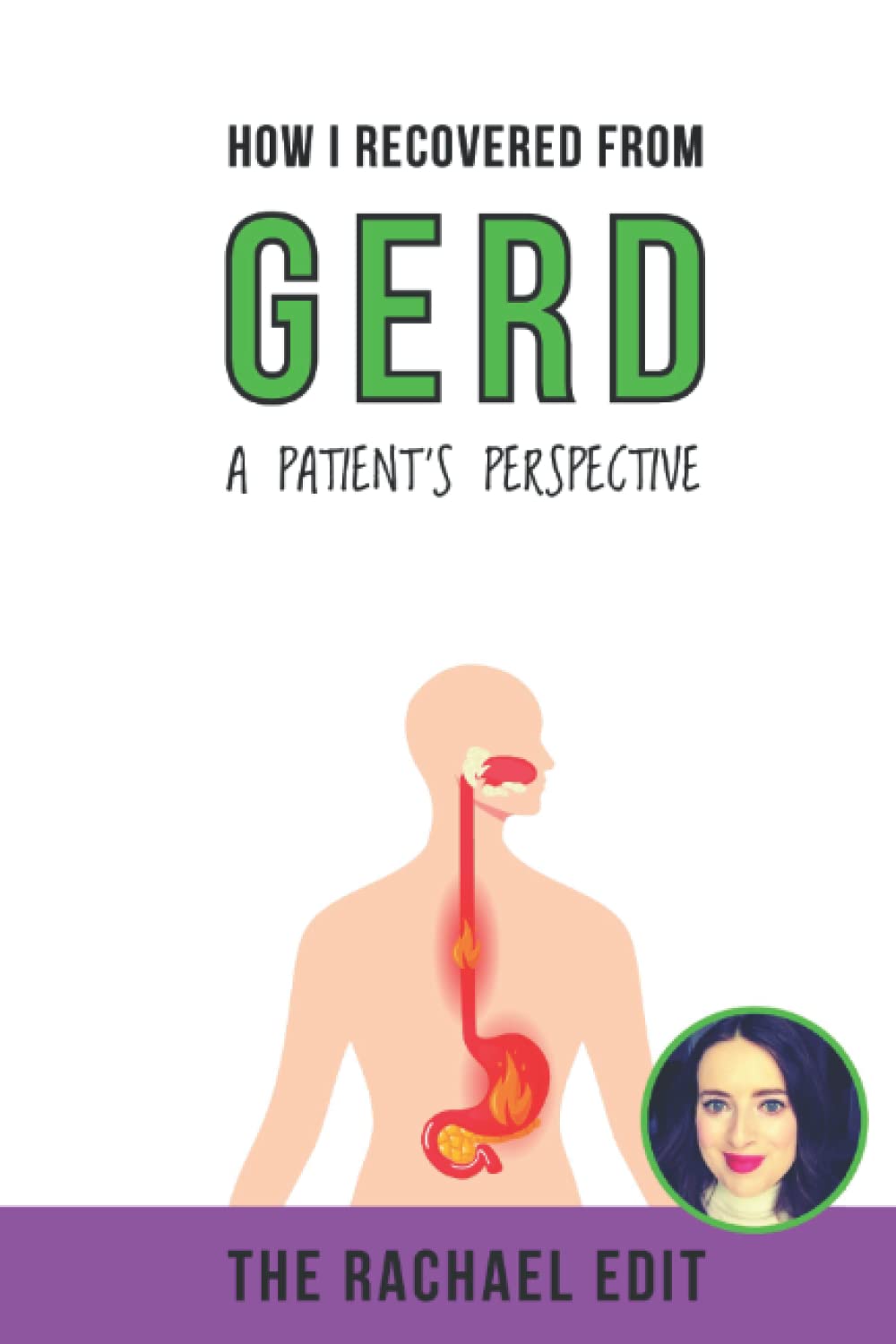 How I Recovered From GERD - A Patient's Perspective