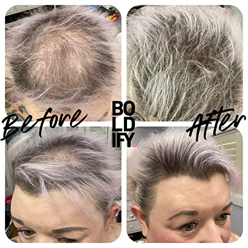Foto von BOLDIFY Streuhaar für Dünner Werdendes Haar Mittel braun, Unsichtbar, Natürlich, Große Flasche, 28 g, Kaschiert Haarausfall in 15 Sek, Haarverdichtung, Haarpuder für Feines Haar, Frauen/Männer