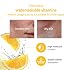 SKINMISO Vitamin C Serum - Brightens, Hydrates & Lightens Dark Spots, For All Skin Types, 0.7 oz