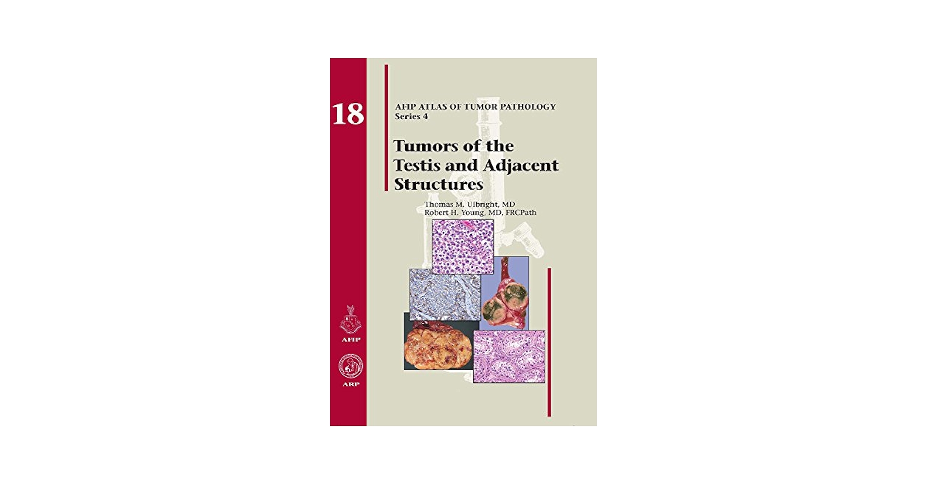 Tumors of the Testis and Adjacent Structures (AFIP Atlas of