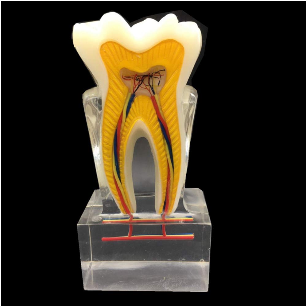 sjdoPulse 6 Times Tooth Nerve Model - Teeth Teaching Model - Tooth Nerve Anatomy Model - Simulation Oral Tooth Teeth Demonstration Model - for Study Teaching (A)