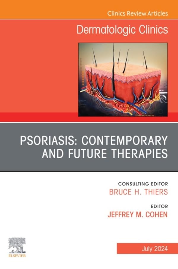 Psoriasis: Contemporary and Future Therapies, An Issue of Dermatologic Clinics, E-Book (The Clinics: Dermatology)