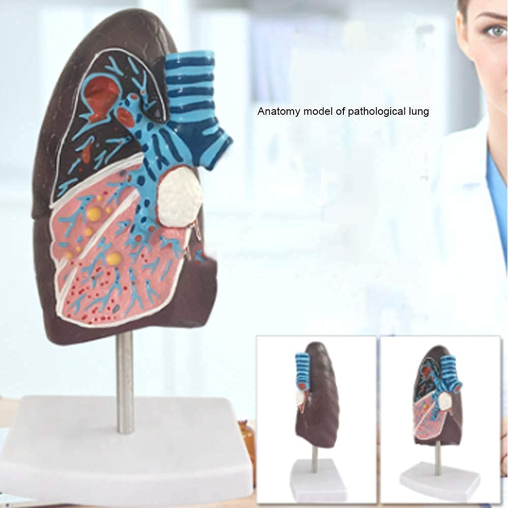 Zusammenbau-Montagemodell, Anatomie-Modell, Lungenorgan, menschliches pathologisches anatomisches Atmungssystem, Modell für Medizin, Biologie, Labor, Wissenschaft, Unterricht, Demonstration für Schul