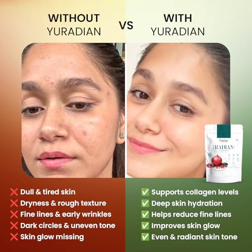 Image of YuRadian 6-In-1 Marine Collagen Powder With Hyaluronic Acid, Vitamin C & E , Lycopene And Peptide | Skin Radiance Collagen Supplement for Women & Men | Youthful Skin Glow, Elasticity & Hydration | No Added Sugar | 15 Servings (150g)