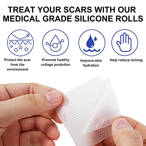 Tempaky Folhas de silicone para cicatriz 3M Fita de gel de silicone macio para cicatriz Rolo de fita