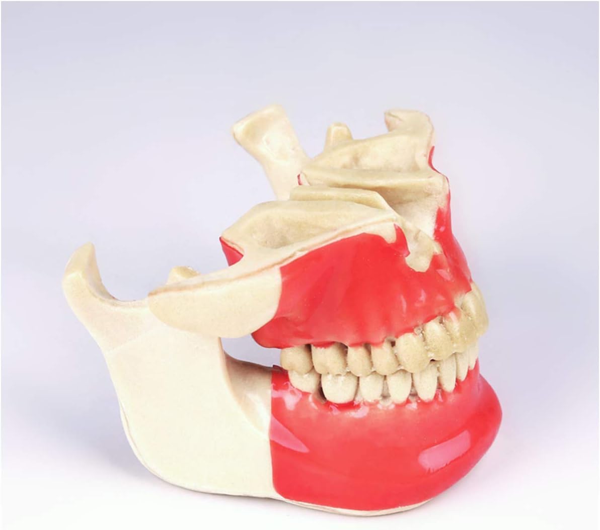Model zęba Choroba implantu dentystycznego Model zębów Student Materiał żywiczny Zestaw do nauczania ustnego