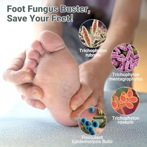 Image of ishancare Extra Strength Antifungal Foot Cream (0.7oz) - Natural Herbal Treatment for Athlete's Foot - Relieves Itching, Burning, Cracking & Fungal Infections
