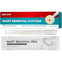 Maximum strength wart removal agent contains salicylic acid 17% works quickly and effectively removes plantar warts, common warts, flat warts, Corn Freezing Fast-Acting Formula for Men and Women4 ml