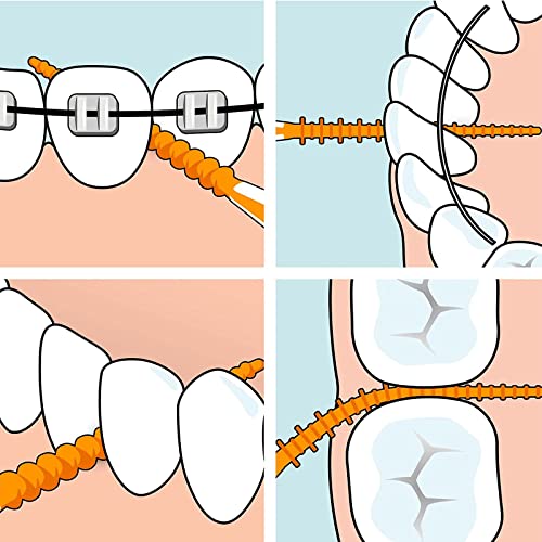 BSITSSS 200 Stück Interdentalbürsten, Zahnzwischenraumbürsten Extra Fein Zahnreinigung Zwischenräume, Weiche Silikon Adaptive Zahnstocher Tragbarer Zahnseide Stick Für Sanfte & Effiziente(Blau) – Bild 5