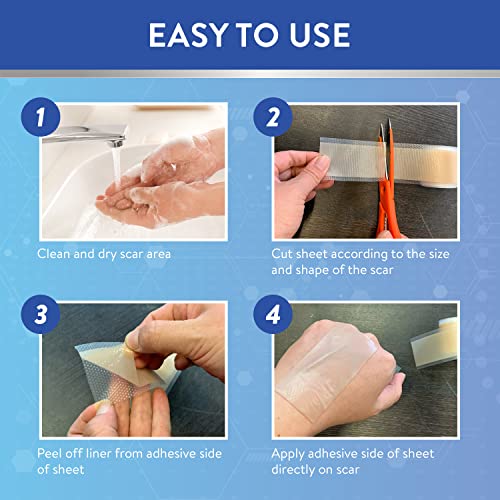 Image of Aroamas Scar Silicone Scar Sheets Scar Removal Silicone Scar Tape 1.6x60 inch for Softening and Flattening Scars, Acne, C-Section, Keloid Surgery, Painless Removal, Reusable, Washable, 6-8 Month Supply