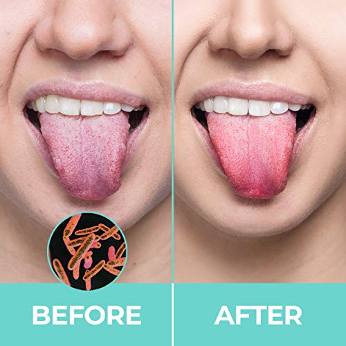 BASIC CONCEPTS Tongue Scraper (3 Pack), Reduce Bad Breath (Medical