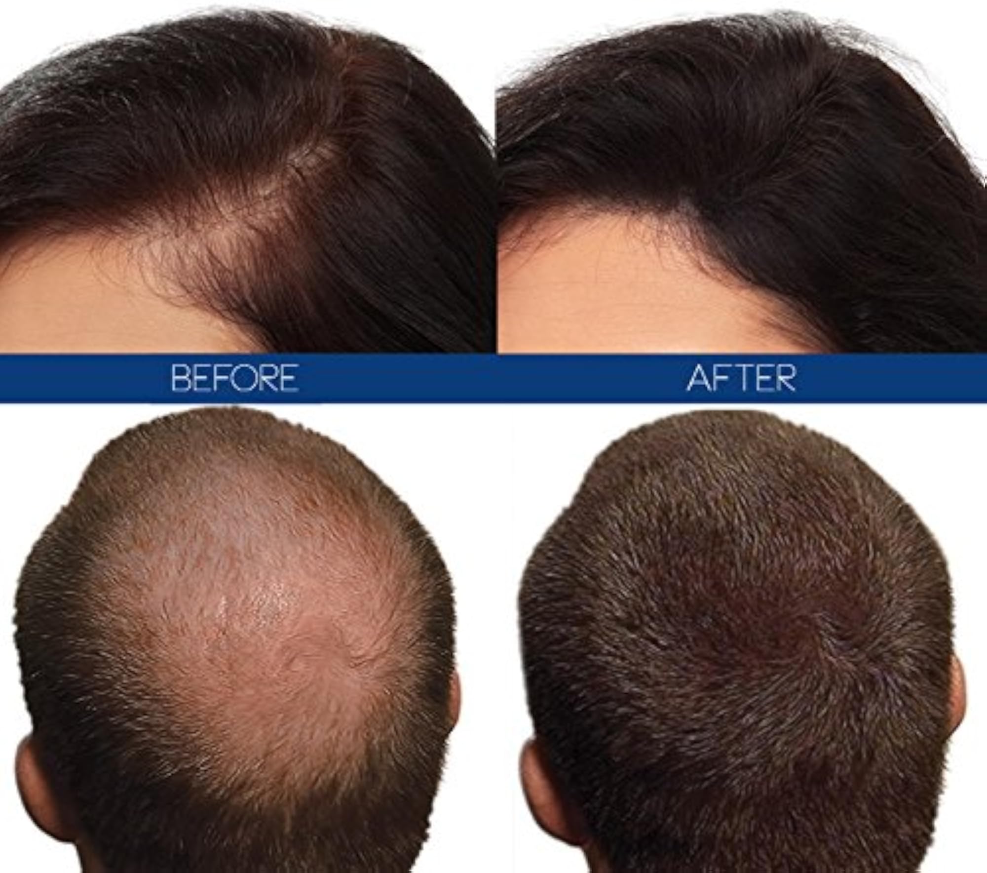 Hair Loss Concealer Fibre, Black, 12 g