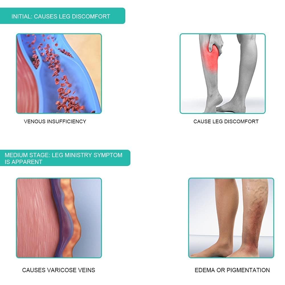 Calf Compression Sleeves for Women & Men - Image 4