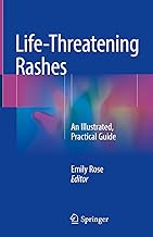 Life-Threatening Rashes: An Illustrated, Practical Guide