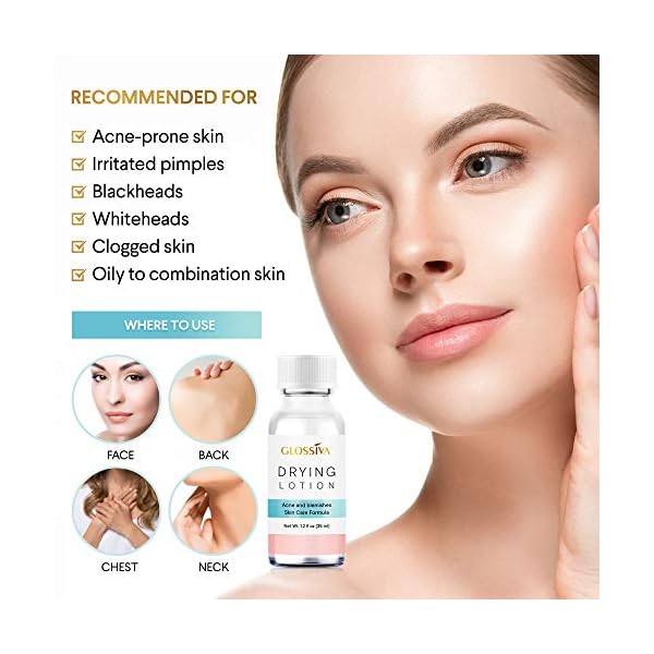 Glossiva-Drying-Lotion-Acne-Spot-Treatment-Dries-Out-Pimples-Blemishes-Zits-and-Clogged-Pores-Overnight-Solution-Powerful-Ingredients-123-Fl-Oz Glossiva Drying Lotion â Acne Spot Treatment, Blemish & Pimple Drying Solution with Overnight Results â 1.23 Fl Oz