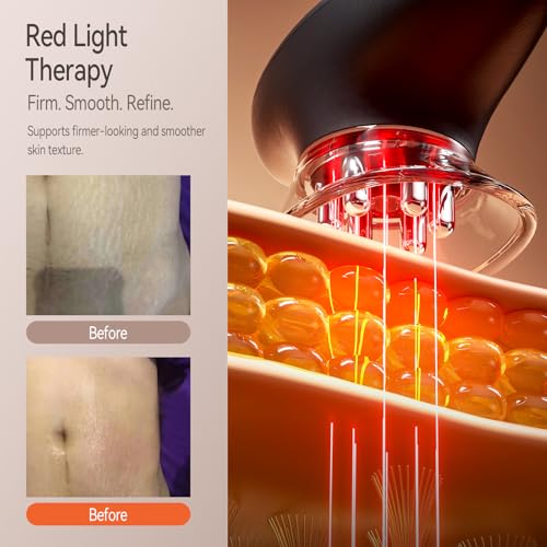Zelvory 3-in-1 Body Sculpting Machine with Red Light, Vacuum Suction & Microcurrent, Cellulite Massage Tool for Arms, Legs, Waist & Belly, Skin Smoothing and Contouring Device for Home Use — view 4
