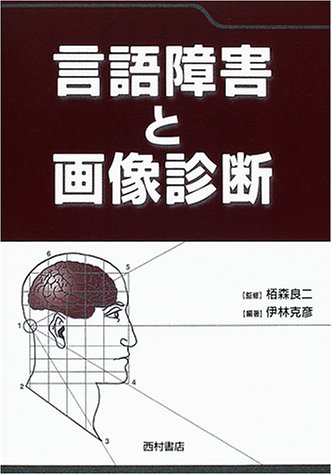無料電子書籍 おすすめ 言語障害と画像診断 バイ