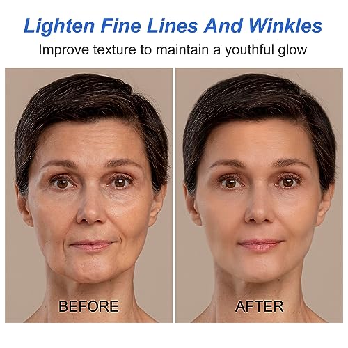 Facial Serum 1 Fl Oz, Anti Aging Serum For Face, Instant Face Tightening, Reduce Fine Lines, Wrinkles, Boost Skin Collagen, Hydrate & Plump Skin — view 5